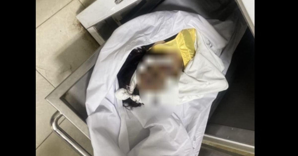 Foto: korban dugaan Penganiayaan di Mimika, Papua.