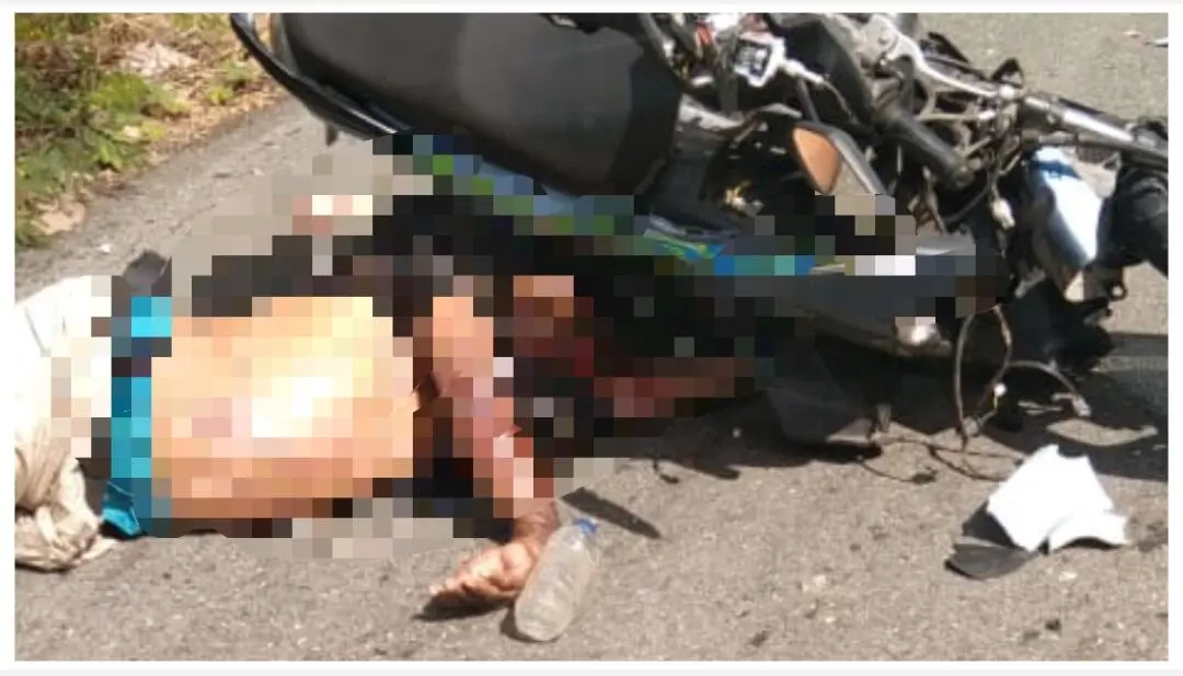 Minim Perhatian Perawatan Jalan Ilngei–Otemer, Satu Korban Terlibat Kecelakaan